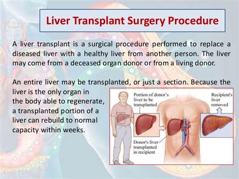 Liver Transplant Surgery And Procedure