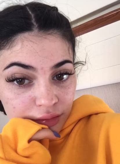 Kylie Jenner No Makeup Pictures Show Her Real Makeup Free Face