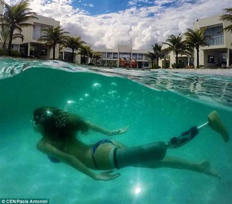 21 Year Old Model Proudly Shows Her Prosthetic Limb In Bikini Women