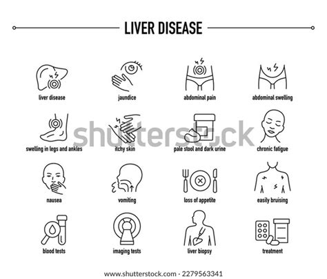Liver Disease Symptoms Diagnostic Treatment Vector Stock Vector