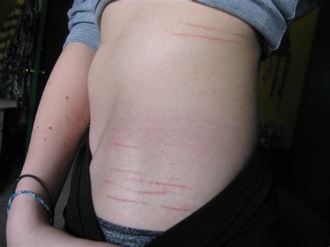 When you have so much bad emotion for something,(ex: Emo Cuts On Wrist Quotes. QuotesGram