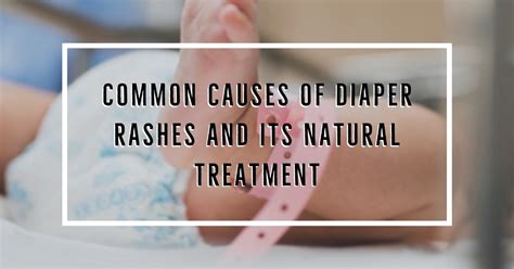 Common Causes Of Diaper Rashes And Its Natural Treatment
