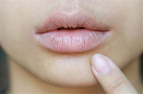 Ini 4 Cara Mengatasi Bibir Kering Secara Cepat Dan Alami