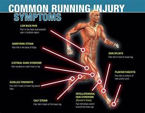 Common Running Injuries Infographic Yuri In A Hurry