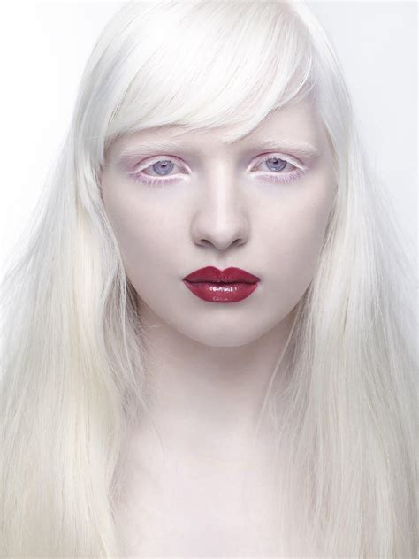 Nastya Zhidkova Albino Model Wearing Red Lipstick I Love The Contrast