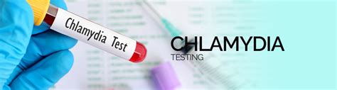 Chlamydia Testing London Symptoms And Treatment Stdcheck Clinic