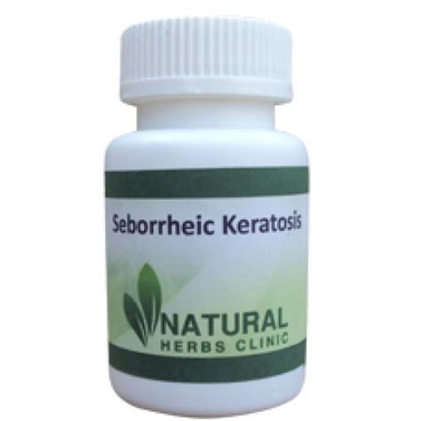 Seborrheic Keratosis Melanoma Skin Cancer Herbal Care Products Hot Sex Picture