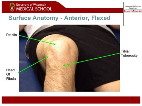 Knee