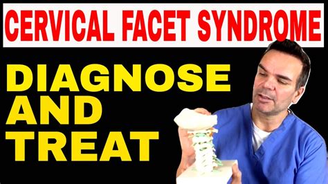Treating Cervical Facet Syndrome YouTube