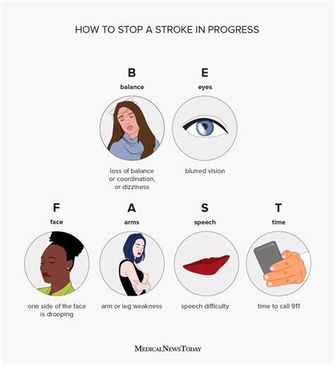 Fast Stroke Signs What Are The Symptoms Of Stroke