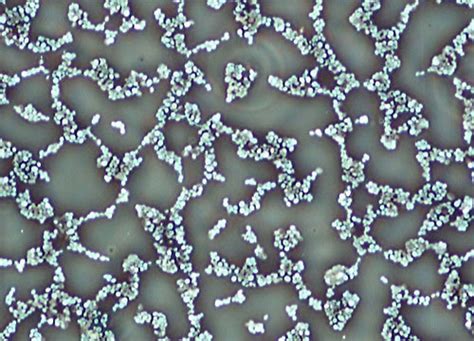 Saccharomyces Yeast Cells Nikons Microscopyu