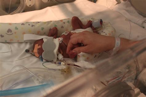 The Baby Born At 24 Weeks Celebrate Every Day With Me