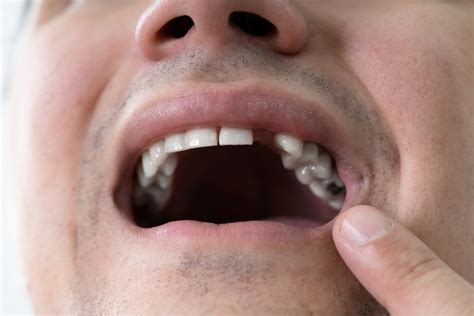 Common Oral Health Problems In Adults Moonriver Pearls