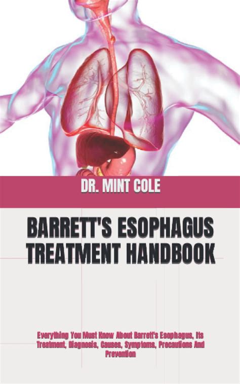 Barretts Esophagus Symptoms And Its Cause Gastroenterologist San Hot