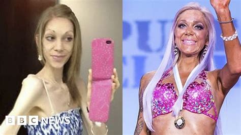 Woman Explains Her Journey From Anorexia To Bodybuilding Champ Bbc News