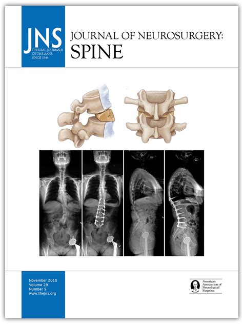 The Comprehensive Anatomical Spinal Osteotomy And Anterior Column