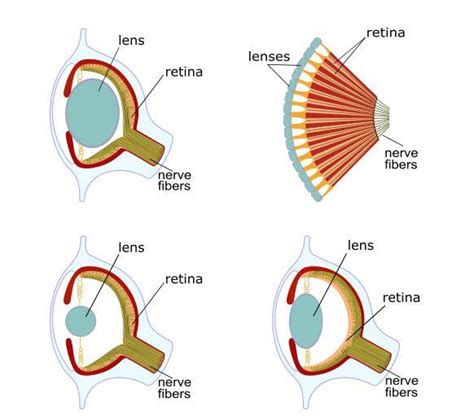 The Diagrams Below Show The Anatomy Of The Eye In Four Different