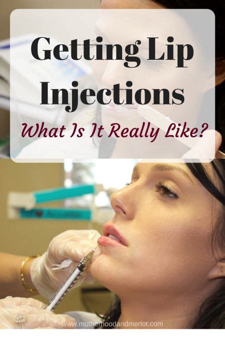 getting lip injections all about the process motherhood and merlot lip injections lips