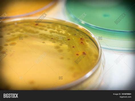 Bacterial Colonies Culture On Macconkey Agar Mediapseudomonas