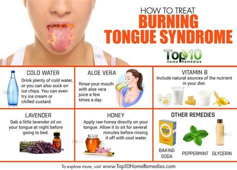 Pin By Helen Justus On Health Remedies Burning Tongue Syndrome