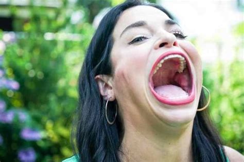 Woman With Worlds Largest Mouth Wins Guinness World Record For 6