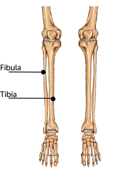 What are the risks of tibia/fibula fracture open reduction and internal fixation? Broken Tibia/Fibula (Shin bone/Calf) | Boston Children's ...