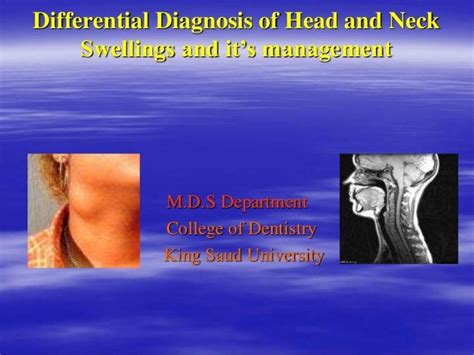 Differential Diagnosis Of Head And Neck Swelling