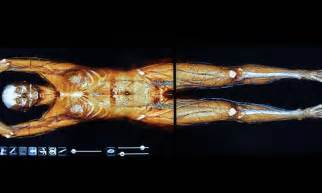The virtual cadaver: Medical students will be able to ...