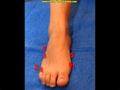 Such corns and calluses can be sprung up anywhere in your foot but are commonly experienced on the top and the lateral side of the foot. foot pain side of foot - YouTube