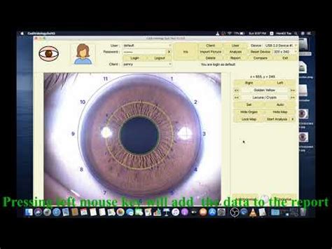 How To Use USB Iriscope Iris Analyzer Iridology Camera Software Video