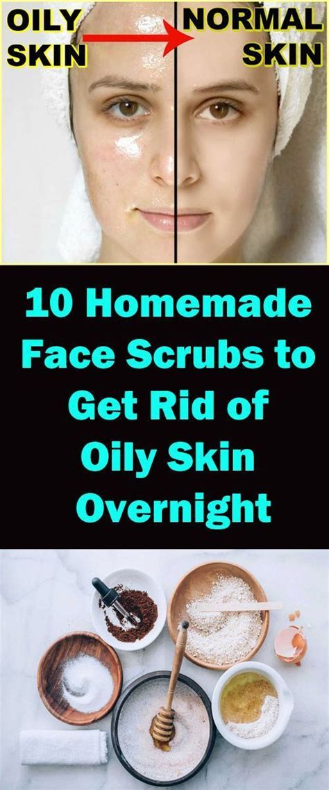 Causes Of Oily Skin 6 Home Remedies To Get Rid Of Oily