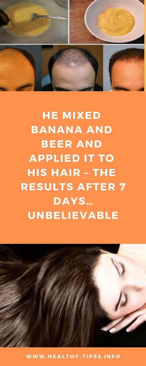 It is most common to have hair loss on the scalp that thins gradually. Pin on Halt Hair Loss Naturally
