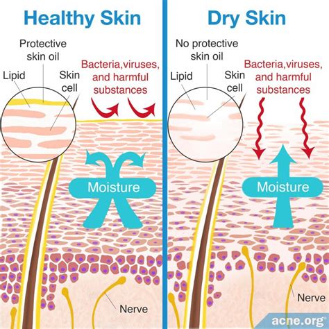 Dry Skin Causes And Treatments Acne Org