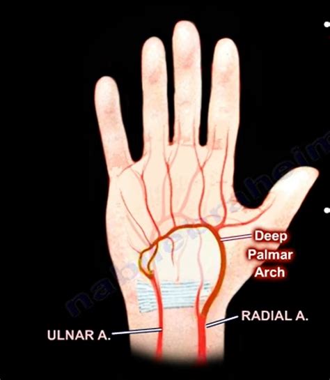 Anatomy Of The Ulnar Artery Bipmd