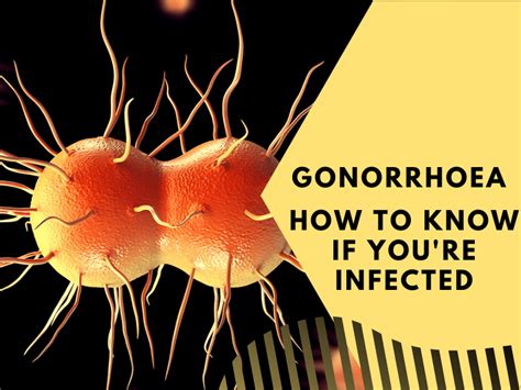 Gonorrhoea How To Know If You Re Infected Filthy
