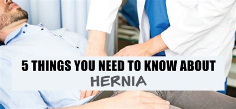 5 Things You Need To Know About Hernia Go Viral Malaysia