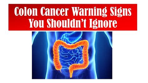 Colon Cancer Warning Signs You Shouldnt Ignore Youtube