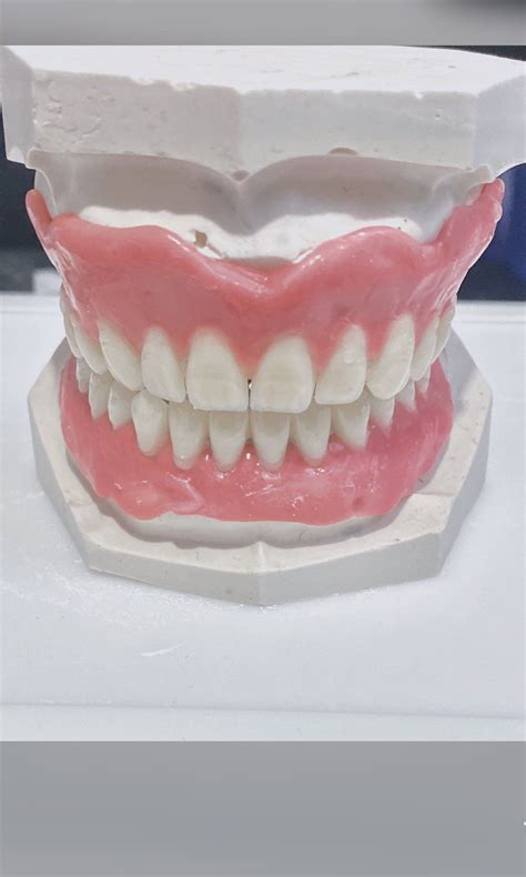 Diy False Teeth Do It Yourself Denture Rosa Diy