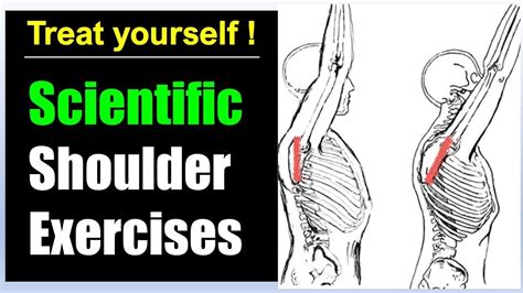 How To Treat Bicep Tendonitis Stretches And Exercises For
