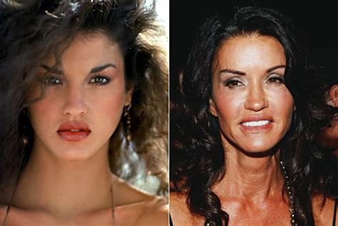 20 Worst Cases Of Celebrity Plastic Surgery Gone Wrong Page 4 Of 5
