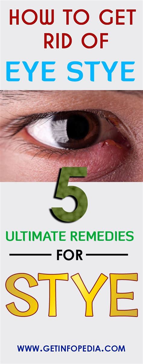 Eye Stye Home Remedies