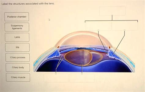 Solved Label The Structures Associated With The Lens Posterior Chamber