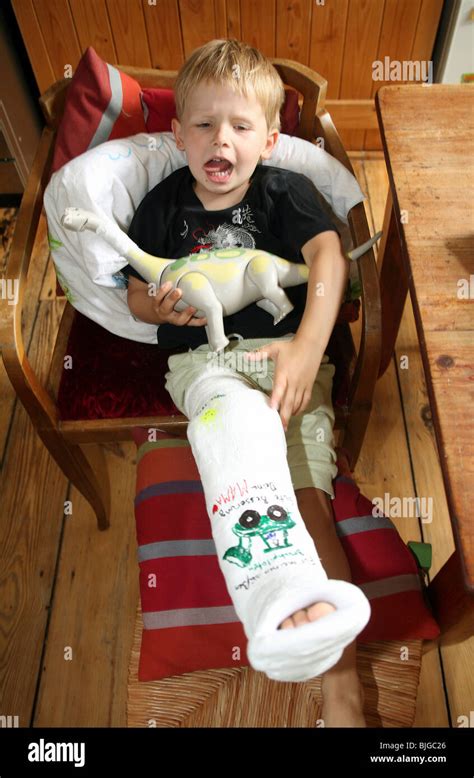 A Boy With His Leg In A Cast Berlin Germany Stock Photo Alamy