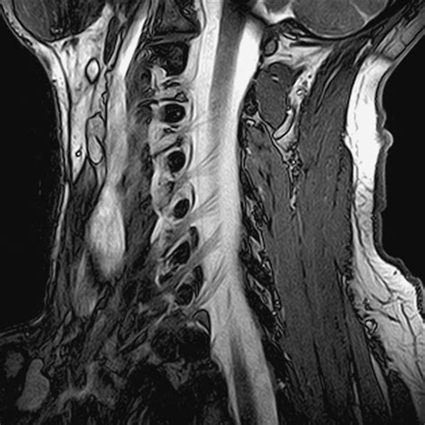 Spine Radiology Key