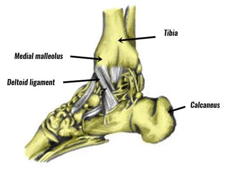 Eversion Ankle Sprain Medial Ankle Sprain