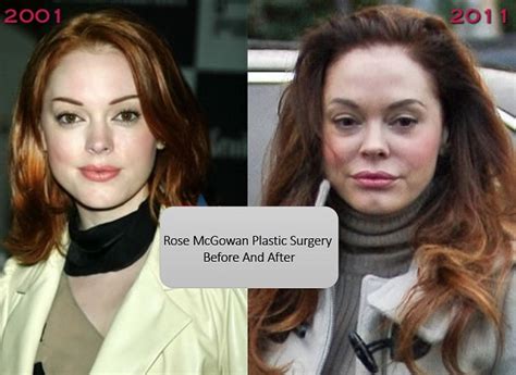 Rose Mcgowan Plastic Surgery Before And After Photos