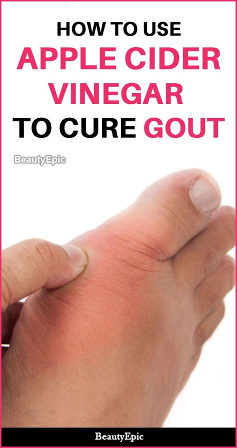 Apple Cider Vinegar For Gout Does It Work Home Remedies For Gout