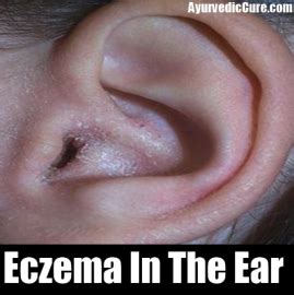 Depending on the issues, you need the appropriate treatment to overcome the problem. Ear Canal at Kent State University - StudyBlue