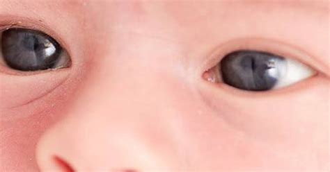 ¿por Qué A Los Bebés Les Cambia El Color De Los Ojos