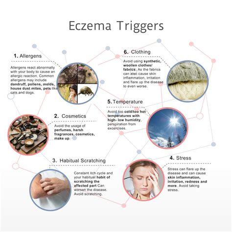 8 Most Common Eczema Triggers In 2019 An Infographic Eczema